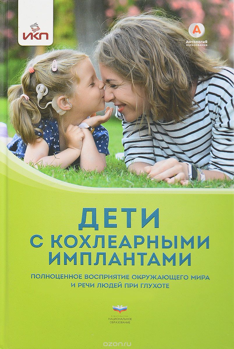 Дети с кохлераными имплантами